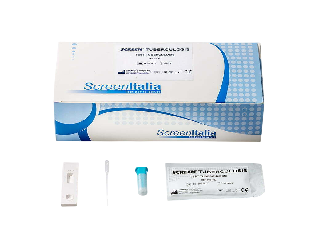 tubercolosi test rapido
